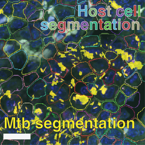 Supplementary Figure S8E Segmentation